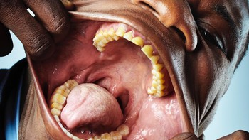 Francisco Domingo Joaquim memegang rekor mulut terlebar sampai 17 cm. Mana yang paling luar biasa menurutmu? Foto: Guinness World Records via Bright Side