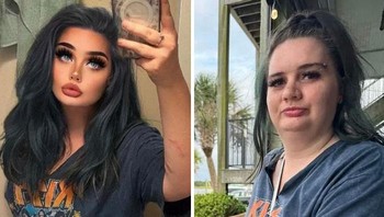 Influencer Memposting Foto-foto Ini Hanya untuk Meminta Sikap Positif pada Photoshop Gila-nya Foto: Boredpanda