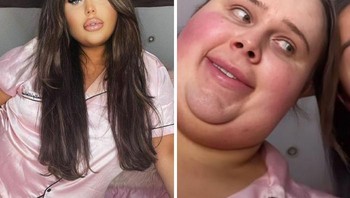 Foto di Medsos vs. Kehidupan Nyata Foto: Boredpanda