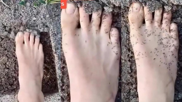 Viral Kaki Dikerumuni Semut Disebut Jadi Tanda Diabetes, Ini Kata Dokter