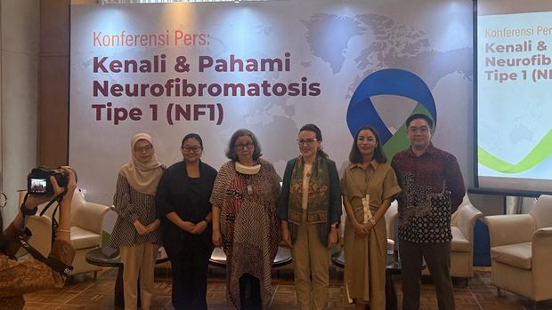 Prof. Dr. dr. Damayanti saat acara Kenali & Pahami Neurofibromatosis Tipe 1 bersama AstraZeneca di kawasan Jakarta Selatan, Rabu (21/5/2025). (CNBC Indonesia/Lynda Hasibuan)