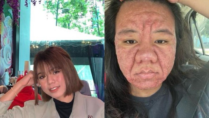 Viral Bumil Curhat Wajahnya Berubah saat Hamil, Insecure seperti Beda Orang