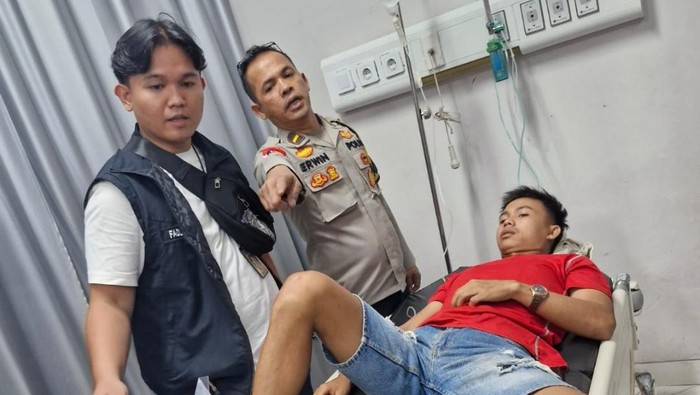 Kondisi kaki korban yang terkena peluru nyasar di Palembang, Sumsel.