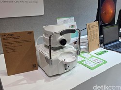 Pakai AI, Acer VeriSee Deteksi Tanda Diabetes dengan Akurasi 93%