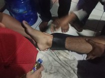 Sandal Nyangkut di Betis, Pemuda Ini Minta Bantuan Petugas Damkar