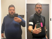 Pria di AS Sukses Pangkas BB 124 Kg Tanpa Operasi, Ini Rahasianya