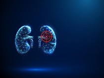 Diabetes Jadi Penyebab Terbanyak Gagal Ginjal, Ini Wanti-wanti Para Dokter