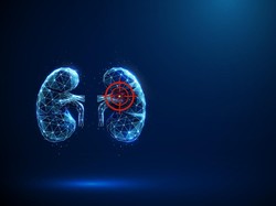 Gaya Hidup dan Pola Makan Seperti Ini Tingkatkan Risiko Kanker Ginjal