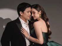 Billy Syahputra Jawab Isu Vika Kolesnaya Hamil