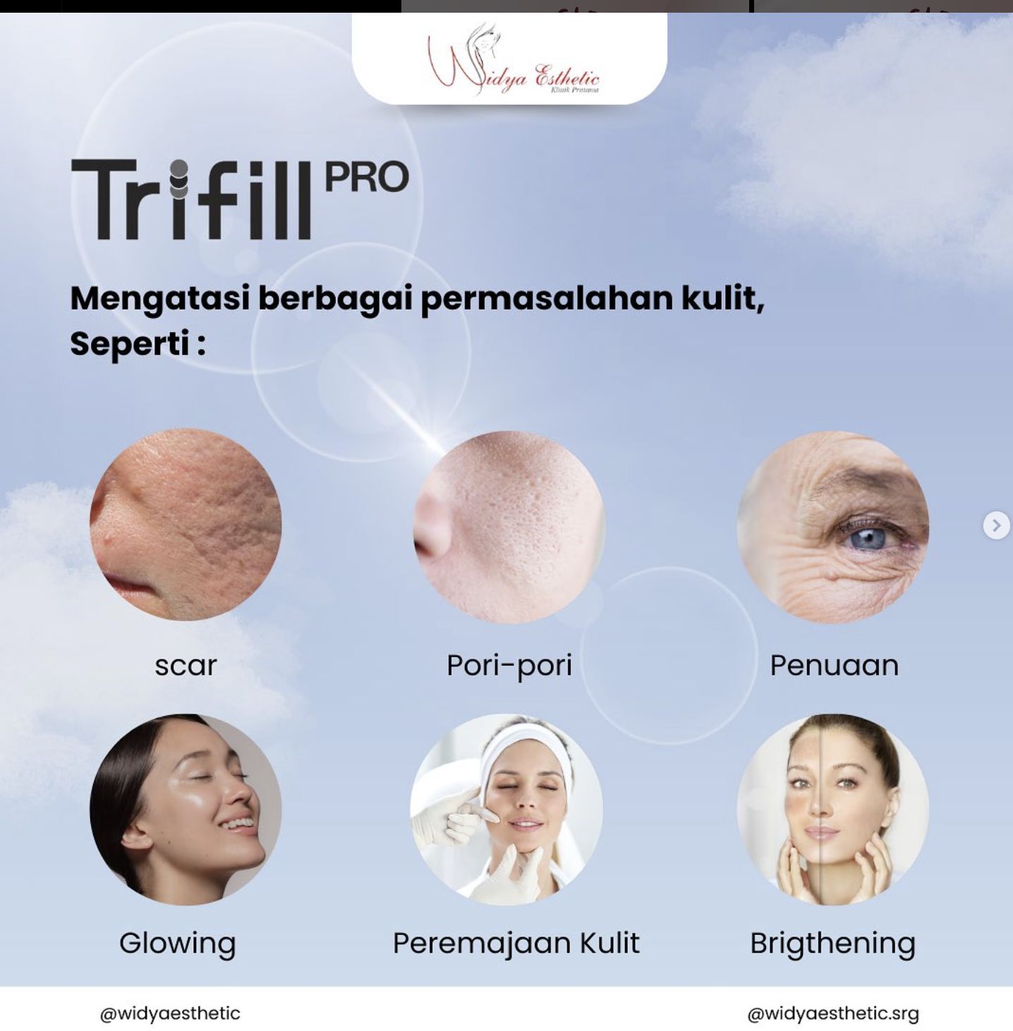 Perawatan Widya Esthetic Clinic