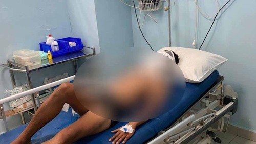 Salah satu korban ledakan speedboat yang dirawat di RS Siloam Labuan Bajo, Manggarai Barat, NTT. (Foto: Istimewa)