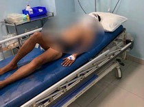 Speedboat Meledak di Labuan Bajo, Pemilik dan ABK Luka Parah
