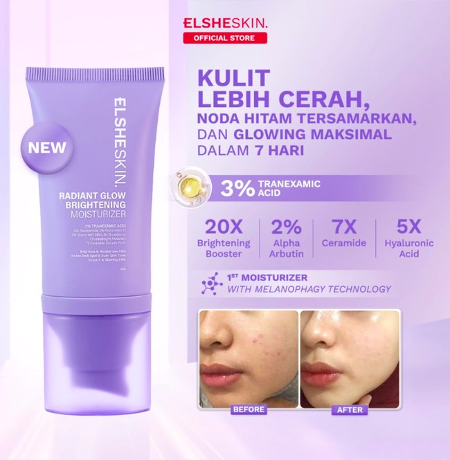 Moisturizer untuk Menghilangkan Bekas Jerawat dan Mencerahkan Moisturizer untuk Menghilangkan Bekas Jerawat dan Mencerahkan