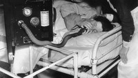Bumil yang menjalani prosedur anestesi hirup saat bersalin. Foto ini diambil bulan Juli 1939.  (Foto: Rare Historical)