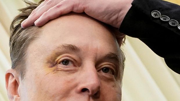 Elon Musk muncul dengan mata memar saat menghadiri konferensi pers bersama Presiden AS Donald Trump di Ruang Oval di Gedung Putih di Washington, D.C., AS, Jumat (30/5) lalu. (REUTERS/Nathan Howard)