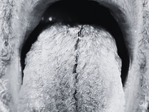 Foto Manusia yang Alami Kondisi Medis Aneh, 100 Persen Nyata Bukan Hasil AI