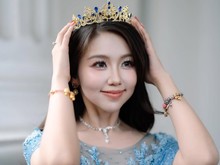 Sosok Vilmei Pacar Willie Salim, Punya 66 Juta Followers!