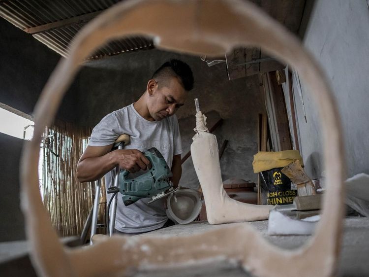 Kaki Palsu Buatan Lembang Beri Harapan bagi Penyandang Disabilitas