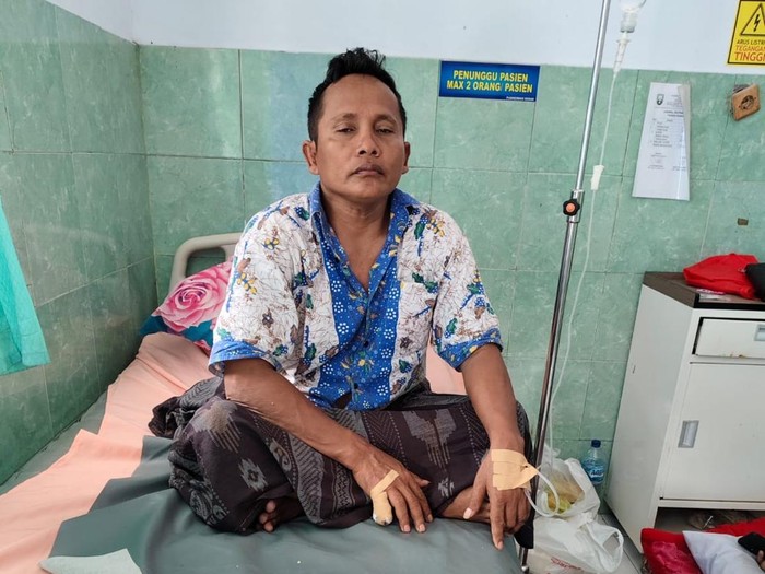 Korban penganiayaan hingga alami putus jari kelingking saat dirawat di Puskesmas Sedan pada November 2024.