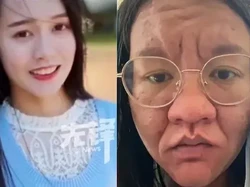 Viral Transformasi Wanita saat Hamil, Wajah Menggelap-Berkerut Bak Beda Orang