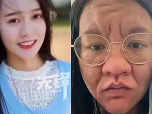 Viral Transformasi Wanita saat Hamil, Wajah Menggelap-Berkerut Bak Beda Orang