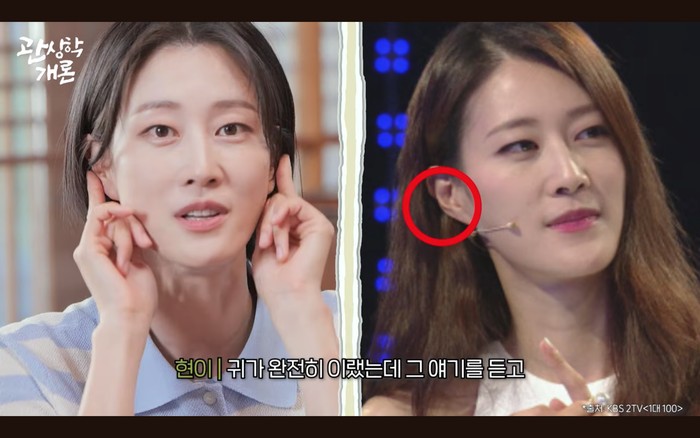 Penyiar Korea Ngaku Pakai Filler Telinga, Alasannya Tak Terduga Demi Cuan