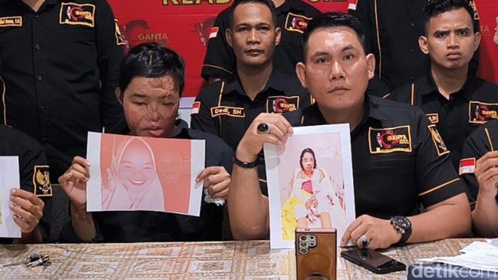 Suryani didampingi kuasa hukumnya saat memberikan keterangan karena suami sirinya belum ditangkap