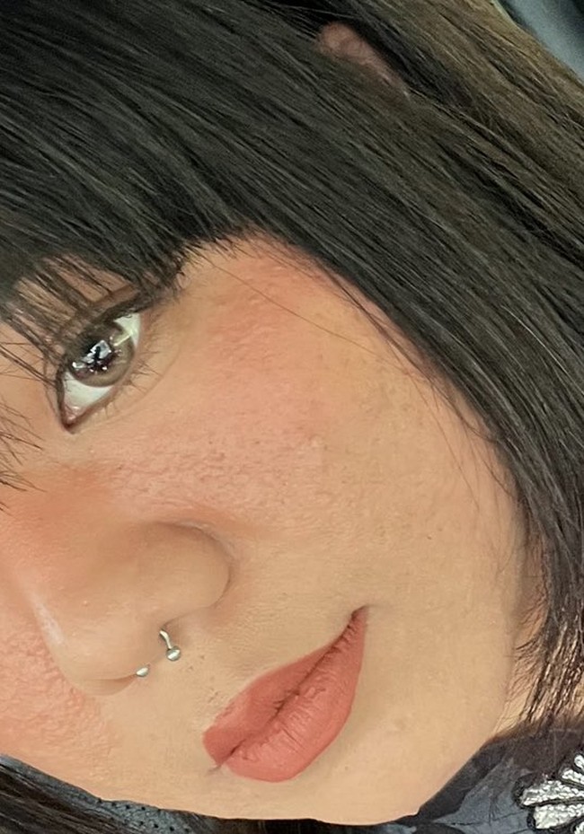 Perubahan tidak berhenti di situ. Pada bulan keempat, Farah menyadari garis senyumnya semakin dalam. Pada bulan keenam, garis kerutan di dahi mulai muncul dan semakin jelas setiap minggunya. Foto: X/@ayyitslala