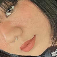 Perubahan tidak berhenti di situ. Pada bulan keempat, Farah menyadari garis senyumnya semakin dalam. Pada bulan keenam, garis kerutan di dahi mulai muncul dan semakin jelas setiap minggunya. Foto: X/@ayyitslala