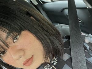 7 Foto Perubahan Wajah Wanita Ini saat Hamil Bikin Kaget: Berubah 100%