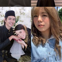 Meskipun perubahan fisik yang dia alami cukup mengejutkan, netizen justru membanjiri unggahan Farah dengan dukungan. Mereka juga mengingatkan kalau kondisi wajah Farah hanya sementara dan semuanya akan kembali baik setelah persalinan. “Kamu pejuang karena bisa jujur soal ini,” tulis seorang pengguna X. Foto: X/@ayyitslala