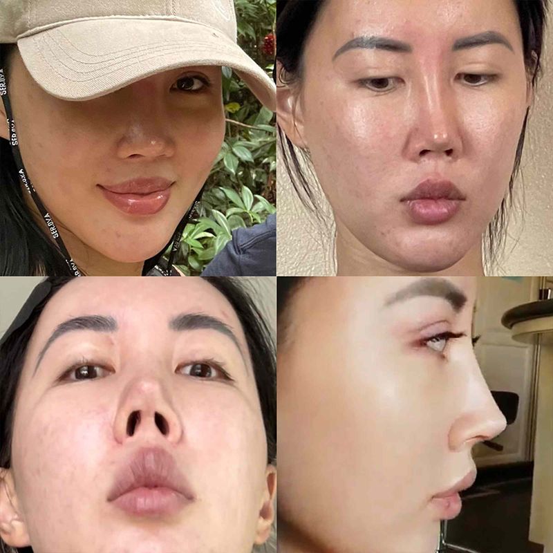 Violet, bintang TikTok operasi hidung karena bosan dengan wajahnya.