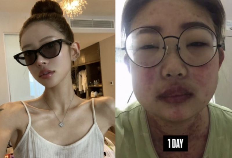 Cerita Anak Artis Manglingi Usai Turun 55 Kg, Dibully Mantan karena Obesitas