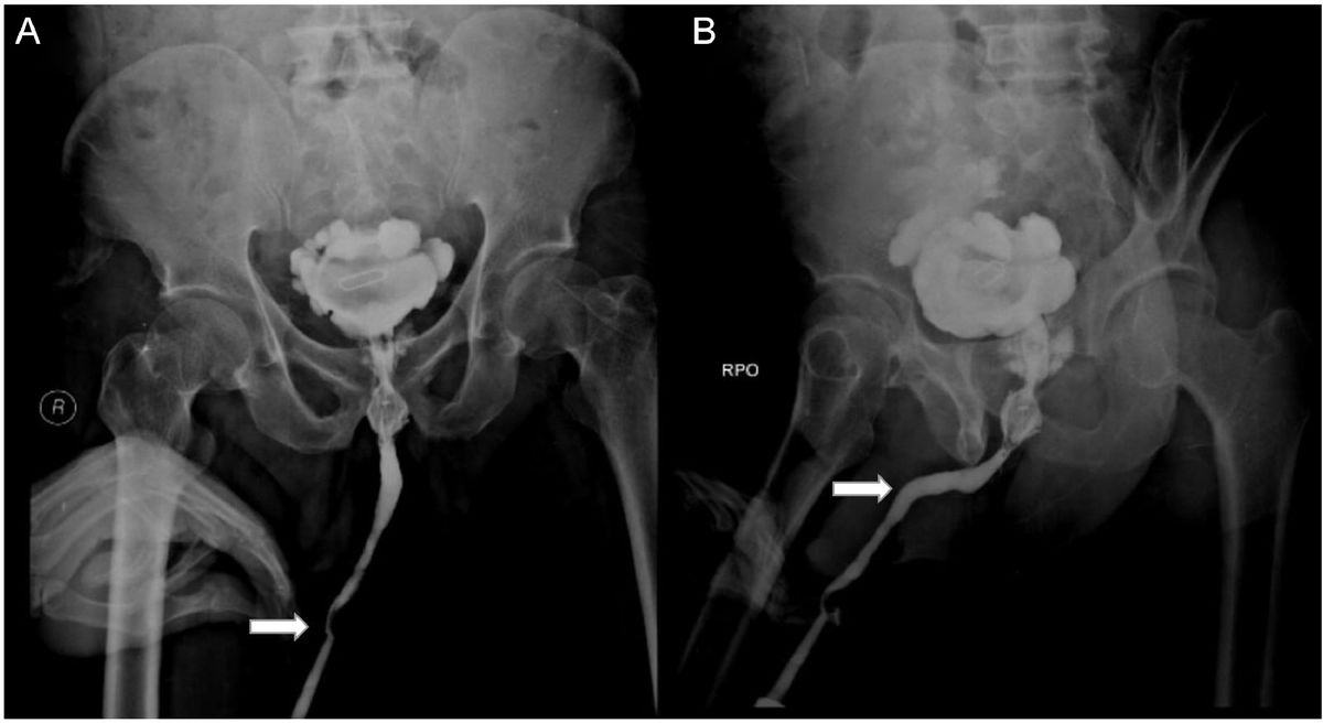 Men yuvinayotganimda yonimga bir odam keldi. Porno. Varshava porno musobaqasini mp4 onlayn tomosha qiling