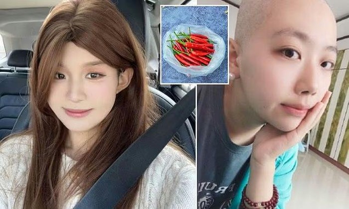 Tragis! Kisah Influencer Tewas karena Terlalu Sering Makan Pedas