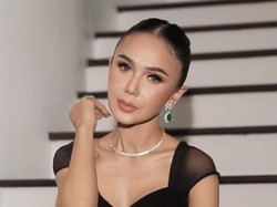 Video Yuni Shara Ngomongin Tren Oplas: Itu Semua Pilihan