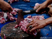 Kata Dokter soal Ciri-ciri Kolesterol Tinggi, Obesitas Lebih Berisiko