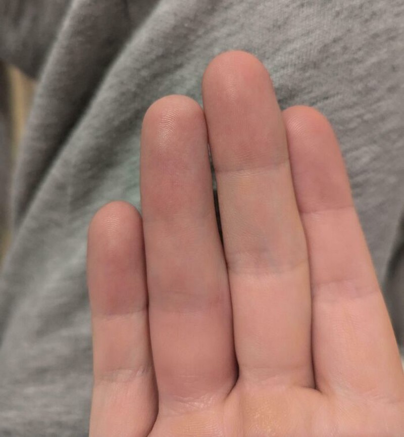 Kondisi Tubuh yang Mengejutkan