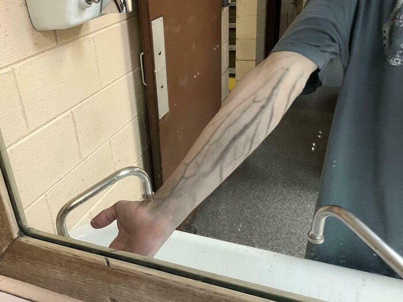 Kondisi Tubuh yang Mengejutkan