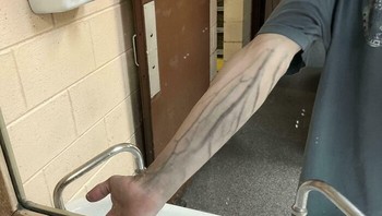 Penampakan pembuluh darah. Foto: Boredpanda