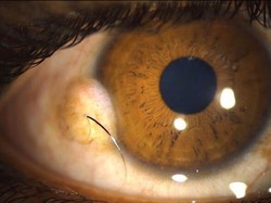 Kondisi Tubuh Manusia Ini Bikin Takjub dan Merinding