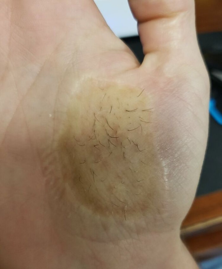 Kondisi Tubuh yang Mengejutkan