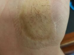 Kondisi Tubuh Manusia Ini Bikin Takjub dan Merinding