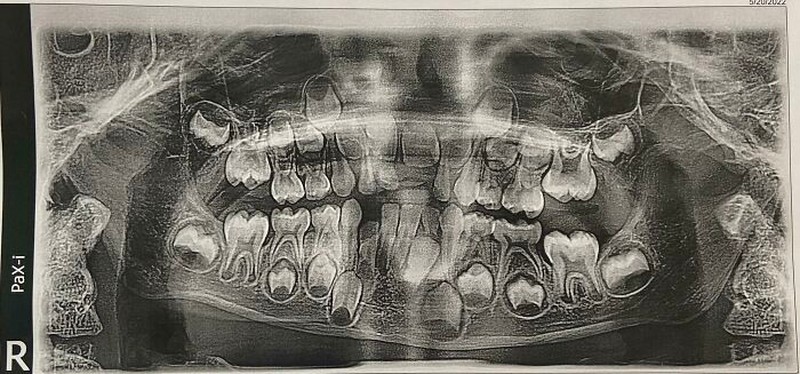 Kondisi Tubuh yang Mengejutkan