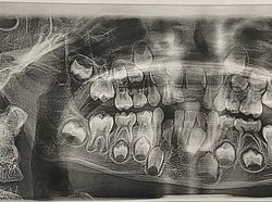 Kondisi Tubuh Manusia Ini Bikin Takjub dan Merinding