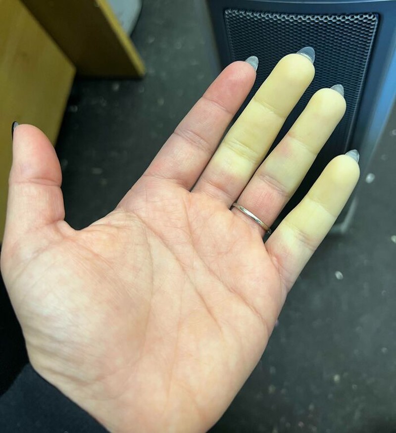 Kondisi Tubuh yang Mengejutkan