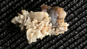 Ini Batu Ginjal Foto: Boredpanda