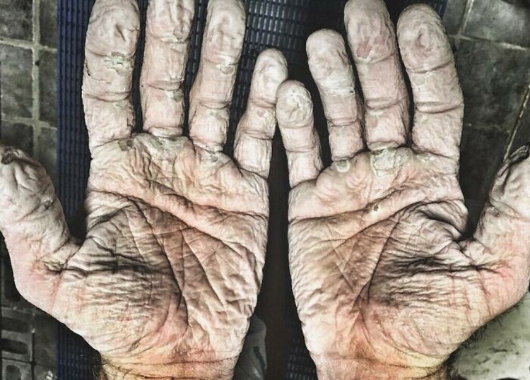 Kondisi Tubuh yang Mengejutkan