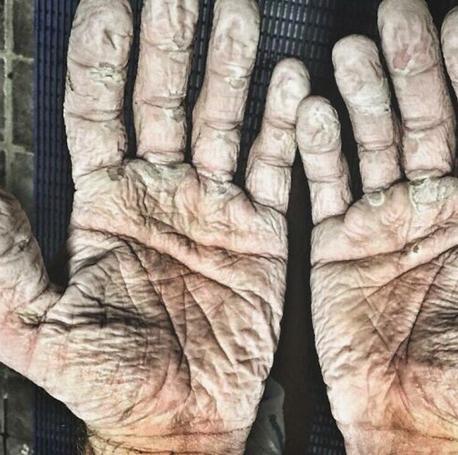 Asli! Ini Foto Kondisi Tubuh Manusia yang Bikin Merinding