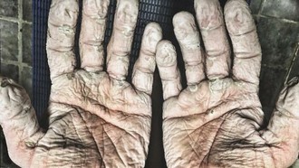 Asli! Ini Foto Kondisi Tubuh Manusia yang Bikin Merinding
